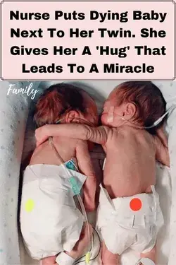 Nurse Puts Dying Baby Next To Her Twin. She Gives Her A 'Hug' That Leads To A Miracle