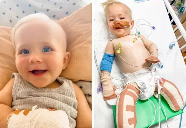 Toddler Loses Legs To Common Infection: ‘Always Trust Your Gut’