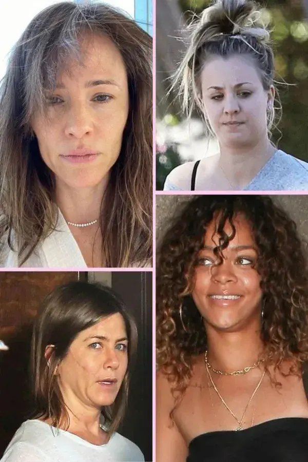 These celebrities went makeup free