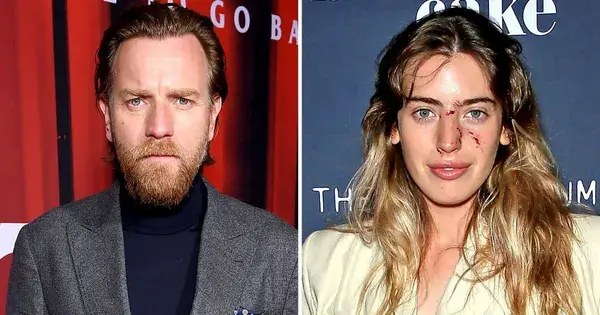 Ewan McGregor's Daughter Shares Horrifying Photos After Facial Dog Bite