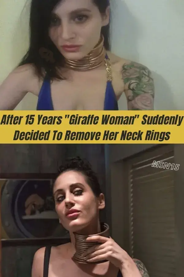 After 15 Years "Giraffe Woman" Suddenly Decided To Remove Her Neck Rings