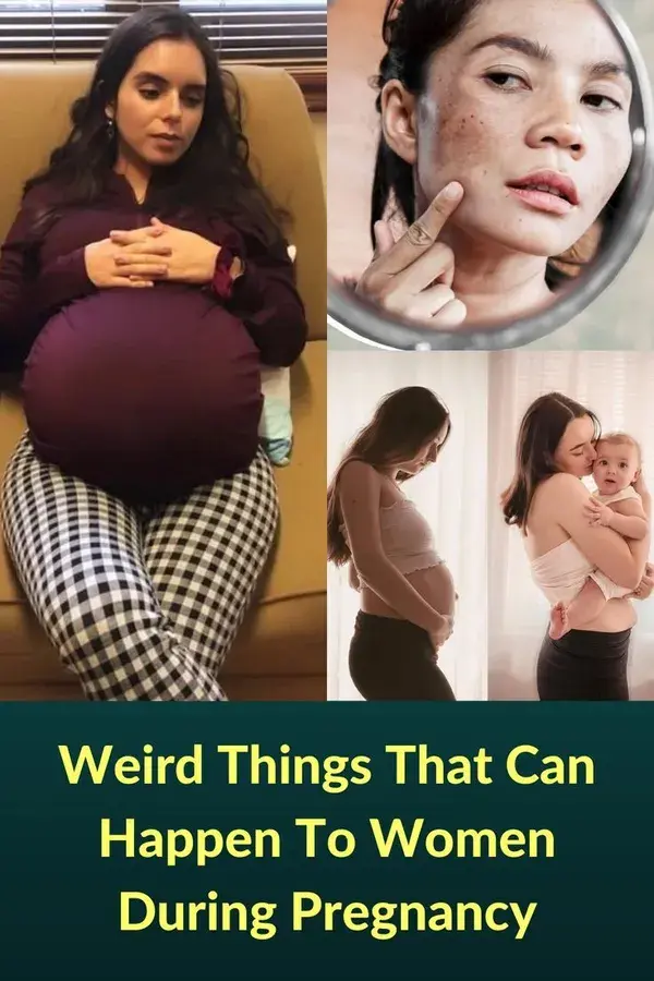 Weird Things That Can Happen To Women During Pregnancy