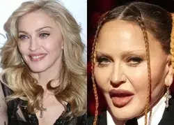 ‘Looks like it hurts’: Madonna’s ‘new face’ shocks fans [photos]
