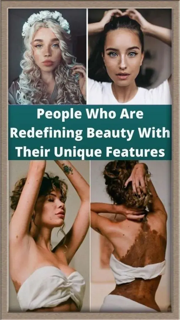 People Who Are Redefining Beauty With Their Unique Features