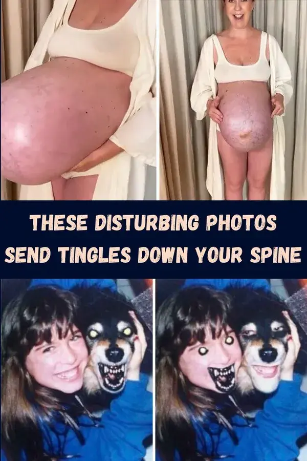 These Disturbing Photos Sent Tingles Down Our Spine