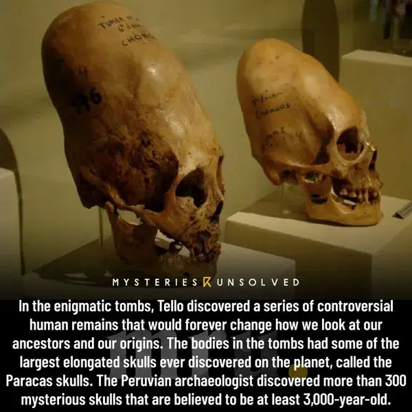 DNA tests reveal that Paracas skulls are not human