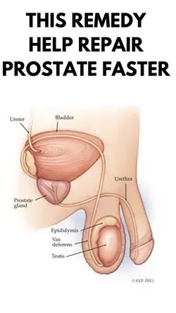Odd Easy Remedy To Repair Enlarged Prostate Faster