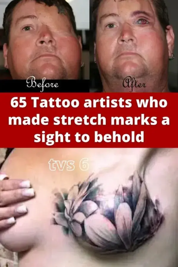 65 Tattoo artists who made stretch marks a sight to behold