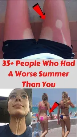 35+ People Who Had A Worse Summer Than You