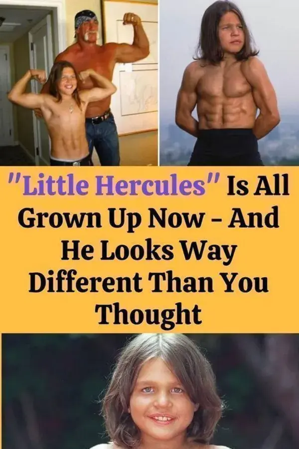 "Little Hercules" Is All Grown Up Now - And He Looks Way Different Than You Thought