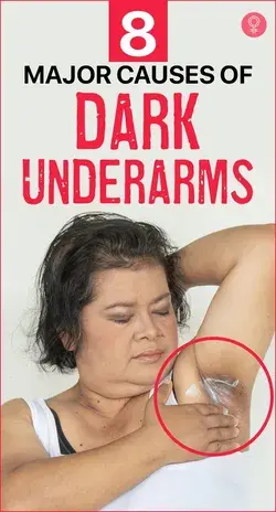 8 Major Causes Of Dark Underarms