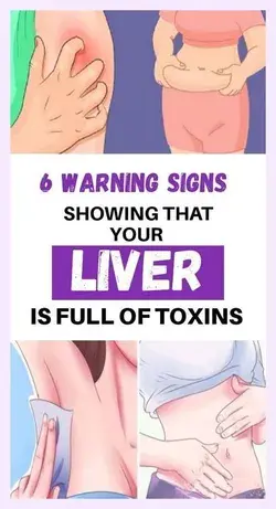 6 Signs That Your Liver Is Full Of Toxins