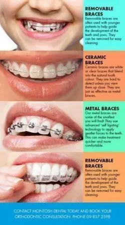 Braces care