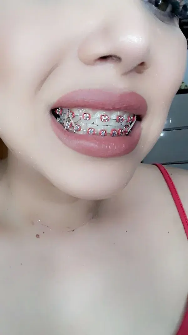 Brakets color  rojo