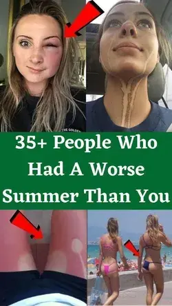 35+ People Who Had A Worse Summer Than You