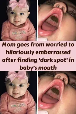 Mom goes from worried to hilariously embarrassed after finding 'dark spot' in baby's mouth