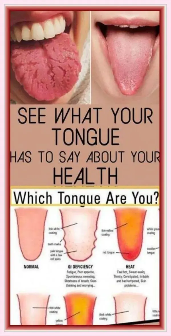 WHAT YOUR TONGUE IS TRYING TO TELL YOU ABOUT YOUR HEALTH