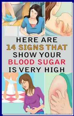14 SIGNS SHOWING THAT YOUR BLOOD SUGAR IS VERY HIGH