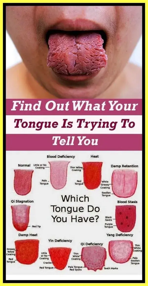 WHAT YOUR TONGUE TELLS ABOUT TOXINS IN YOUR BODY