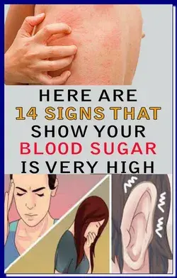 14 SIGNS SHOWING THAT YOUR BLOOD SUGAR IS VERY HIGH