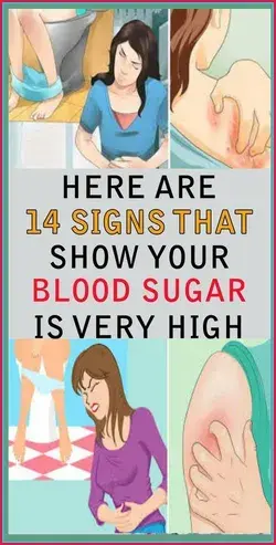 14 Signs Showing That Your Blood Sugar Is Very High