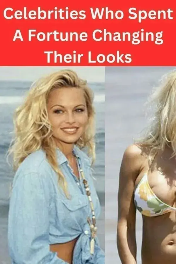Celebrities Who Spent A Fortune Changing Their Looks