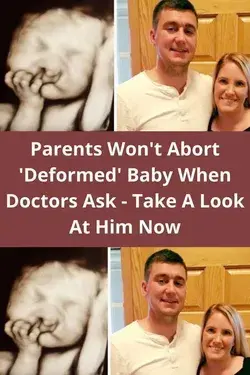 Parents Won't Abort 'Deformed' Baby When Doctors Ask - Take A Look At Him Now