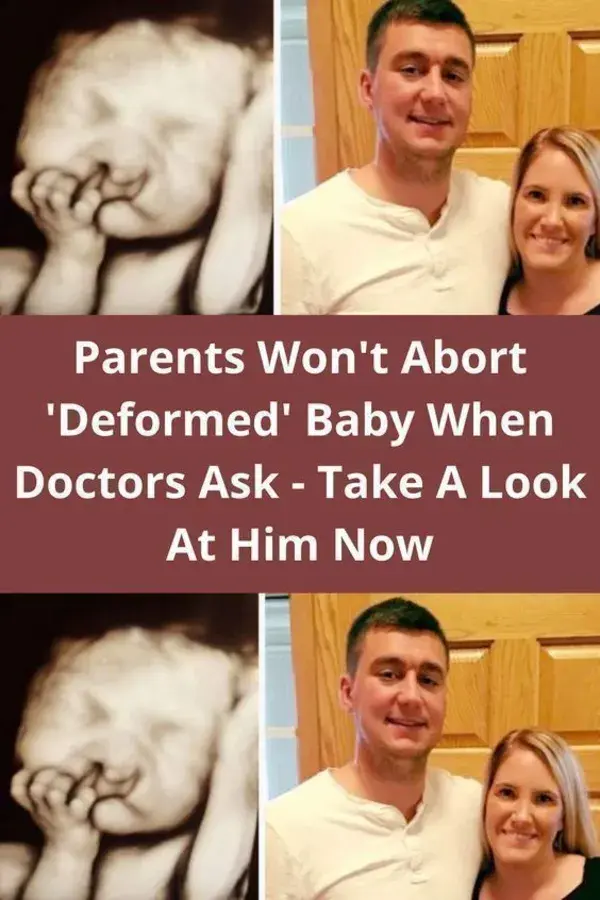 Parents Won't Abort 'Deformed' Baby When Doctors Ask - Take A Look At Him Now