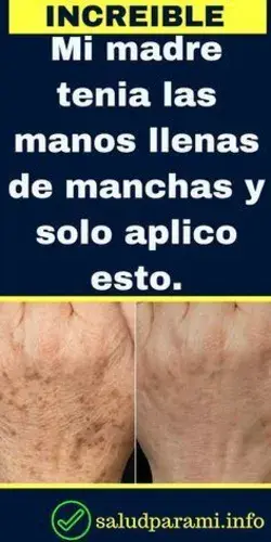 Dermatología estética: tratamientos profesionales para mejorar la apariencia de la piel