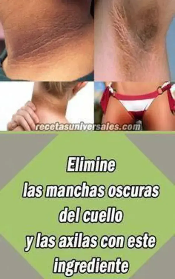 Adiós a las manchas oscuras, las pecas y las arrugas