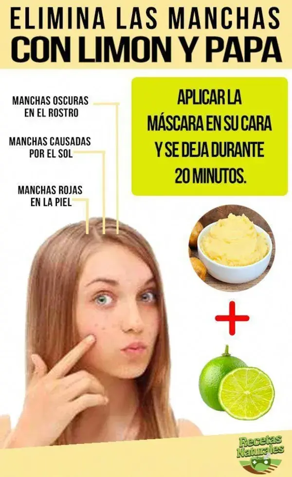 Elimine las manchas en su cara en solo 3 noches, con este remedio casero