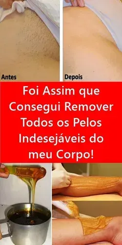 Foi Assim que Consegui Remover Todos os Pelos Indesejáveis do meu Corpo!