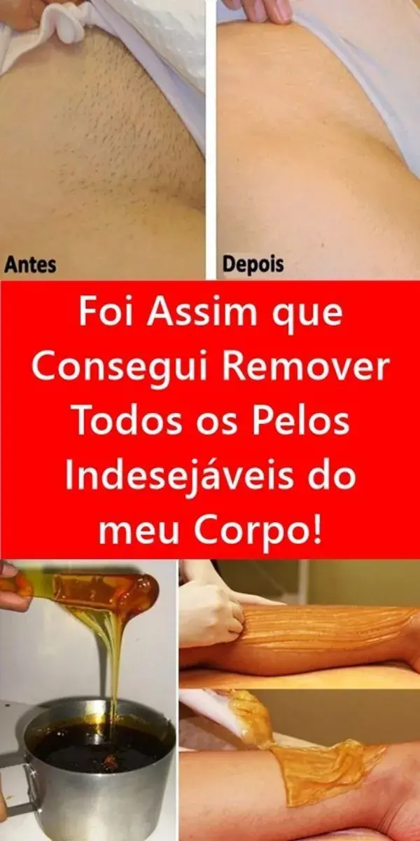 Foi Assim que Consegui Remover Todos os Pelos Indesejáveis do meu Corpo!