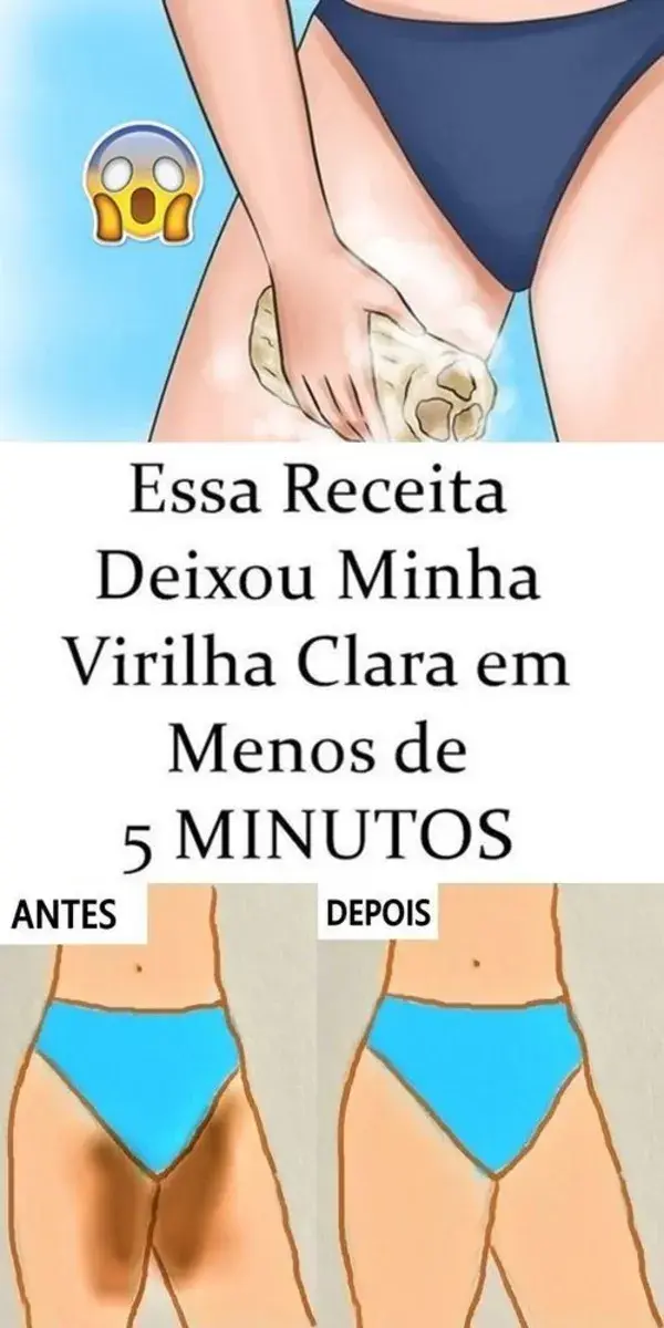 Dicas para clarear a virilha em casa sem gastar muito