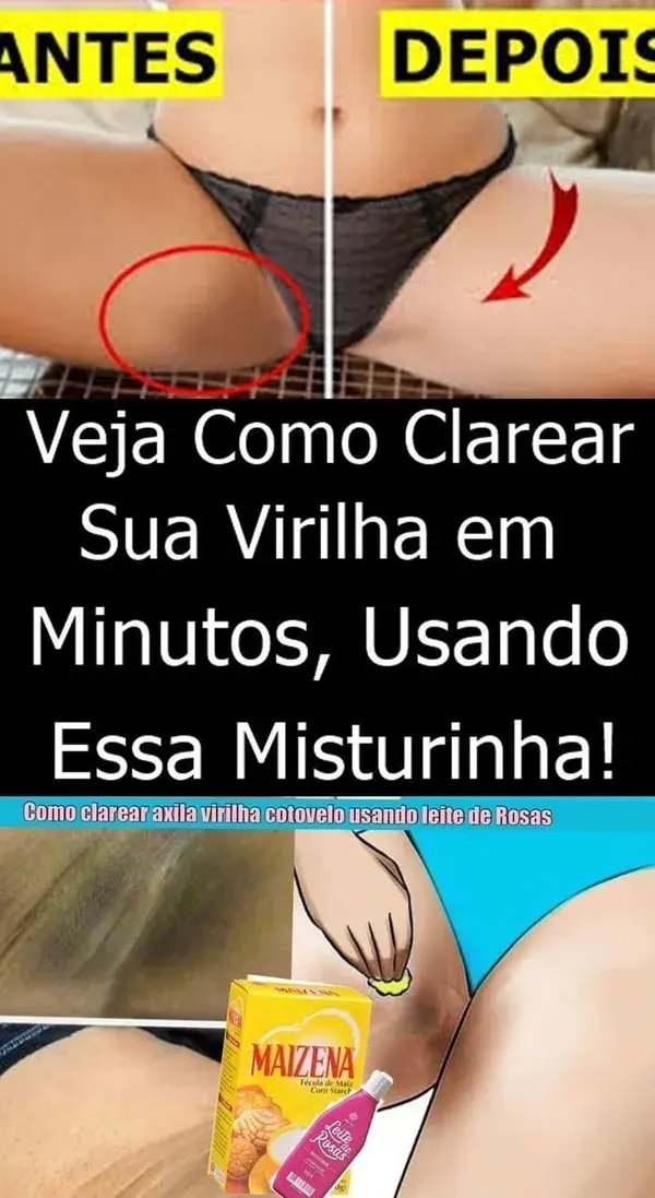 Como clarear a virilha sem causar irritação na pele sensível