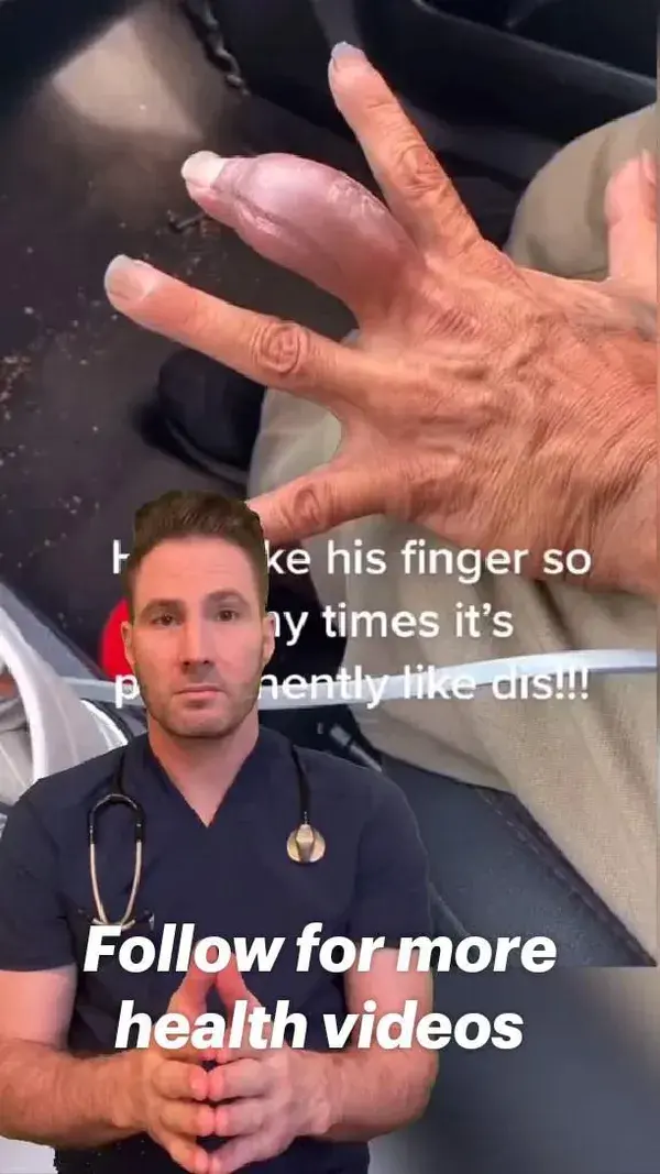 Follow for more health videos