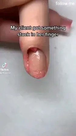 Sometimes stuck in nail