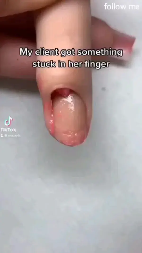 Sometimes stuck in nail