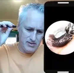 Ear wax remover (HD 1080p wireless)