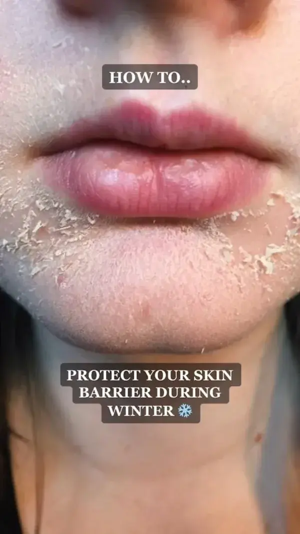 protect your skin