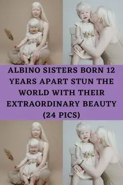 Albino Sisters Born 12 Years Apart Stun The World With Their Extraordinary Beauty (24 Pics)