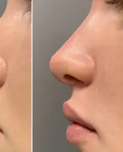 perfect nose