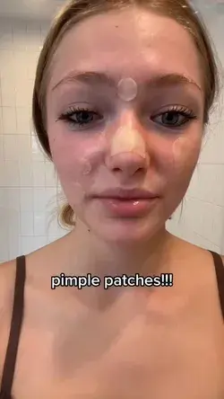 This is proof that there is value in buying actual pimple patches!