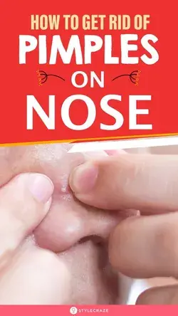 How To Get Rid Of Pimples On Nose