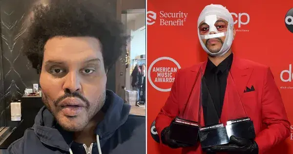 The Weeknd finally explains his face bandages are a reflection of ‘absurd culture of Hollywood’