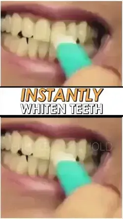 🔥instant whitening kit 🔥