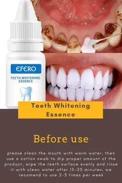 Natural Teeth Whitener