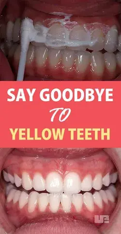 SAY GOODBYE TO YELLOW TEETH