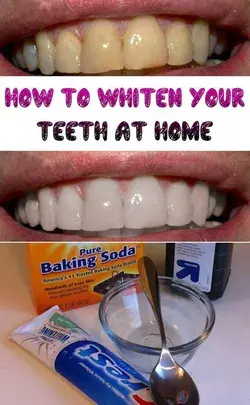 How to white your teeth at home