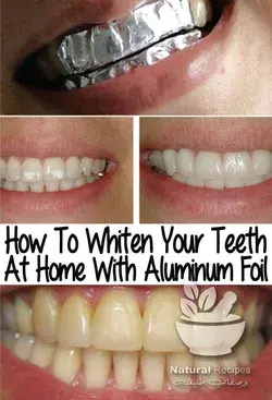 How To Whiten Your Teeth At Home With Aluminum Foil